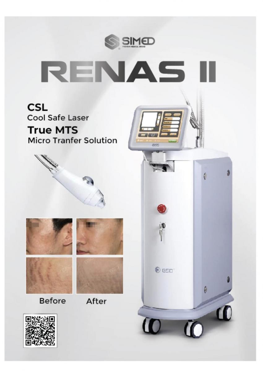 Renas II laser 1550nm: Đột phá trong công nghệ điều trị sẹo 